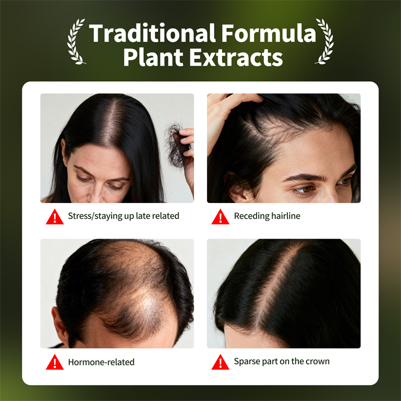 天然育毛セット ウスマン草シャンプー石鹸 ハーブ育毛オイル  - Epidermal Growth Factor のレビューと価格