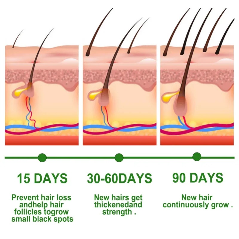 育毛血清高速成長ヘアケアセットエッセンシャルオイル濃密な再成 - Epidermal Growth Factor のレビューと価格