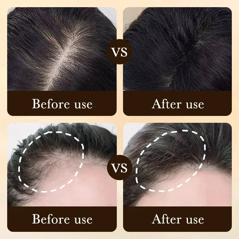 ビオチン配合育毛オイル製品、頭皮マッサージトリートメント、脱 - Epidermal Growth Factor のレビューと価格