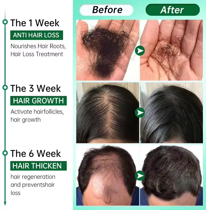育毛血清 7 日間高速再生エッセンシャルカプセル抗脱毛ハゲ修 - Epidermal Growth Factor のレビューと価格