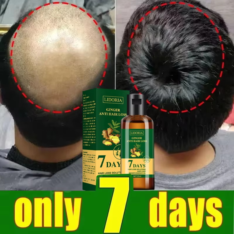 育毛血清 7 日間高速再生エッセンシャルカプセル抗脱毛ハゲ修 - Epidermal Growth Factor のレビューと価格