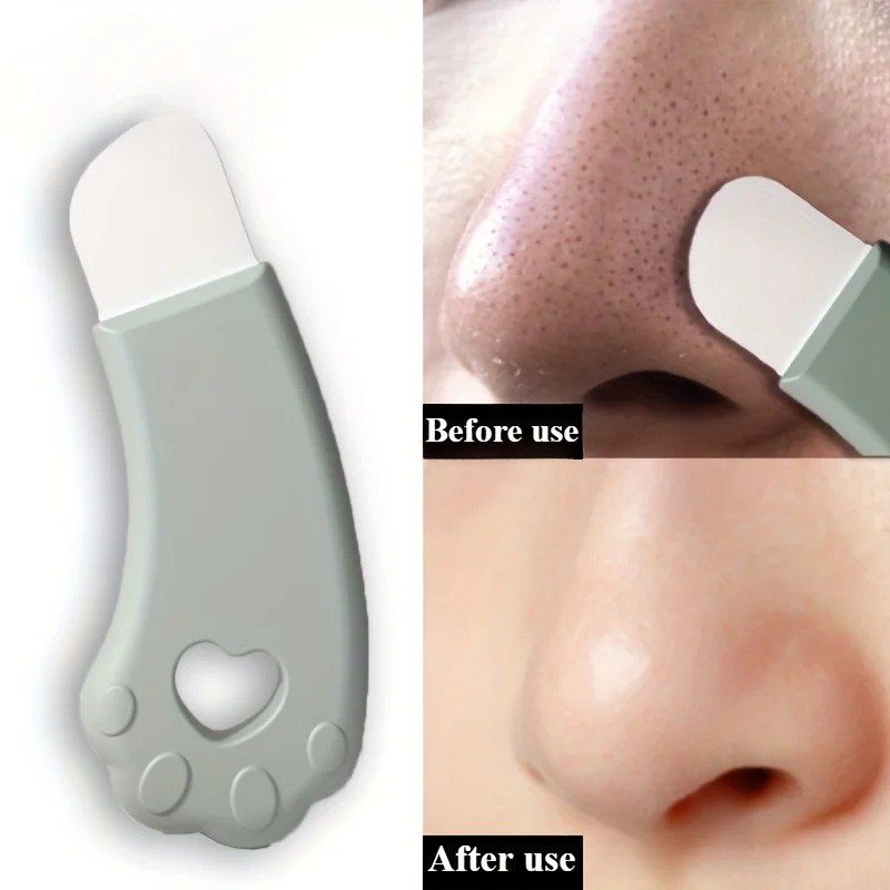 猫の爪型黒ずみ除去ツール、手動式顔用ニキビ除去スパチュラ、毛 - Luxury Skincare Acne のレビューと価格