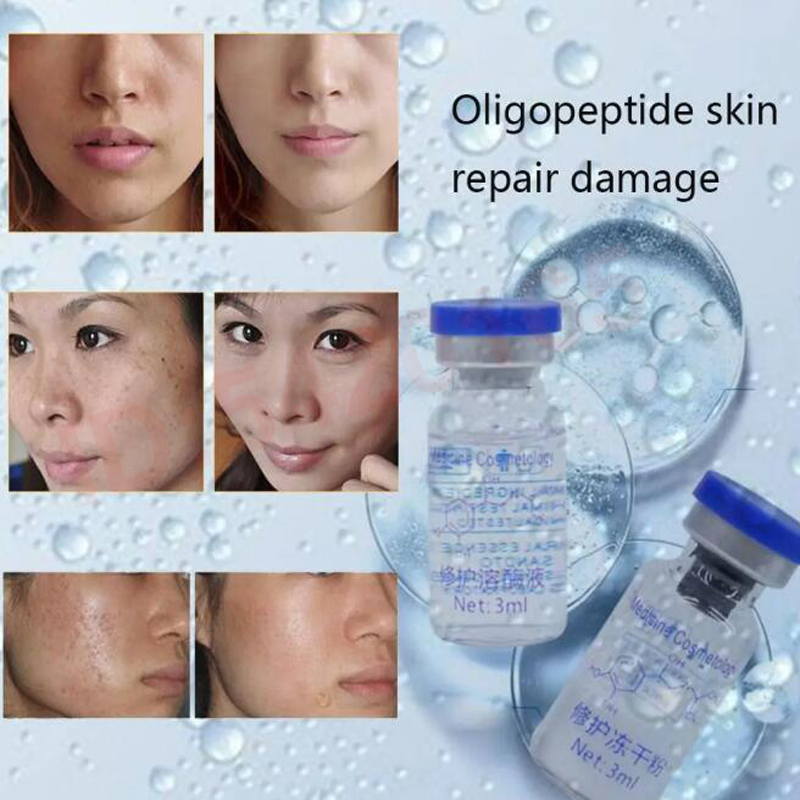 オリゴペプチド凍結乾燥パウダーエッセンス修復顔の保湿栄養毛穴 - Epidermal Growth Factor のレビューと価格
